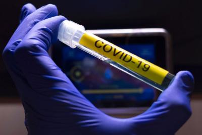 Covid-19: países devem se preparar para surtos recorrentes pelos próximos 2 anos