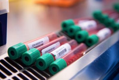 Anticoagulante inibe replicação do vírus da Covid-19