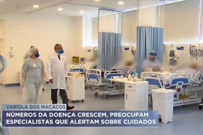 Varíola dos macacos: números preocupam especialistas que alertam sobre cuidados